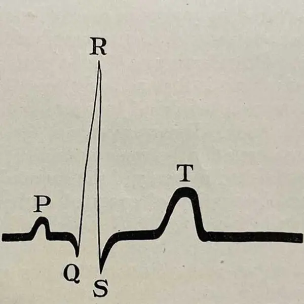 The Electrocardiogram in Clinical Medicine